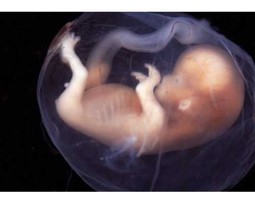 武汉代妈价格助孕,武汉协和医院助孕单周期至少3个月？8.8万够吗？